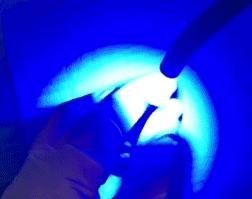 进行防龋齿牙齿窝沟封闭工作,窝沟封闭是保护牙齿最有效的方式