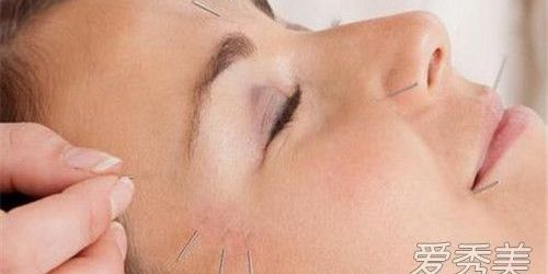 针灸瘦脸脸部会紧实吗,瘦脸针灸视频全过程