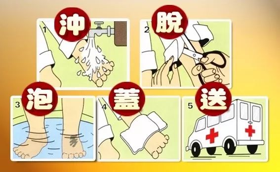 正确处理烫伤视频,烫伤的应急处理方法的正确顺序是