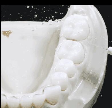 最好用的冲牙神器,推荐一款超级小巧的冲牙器