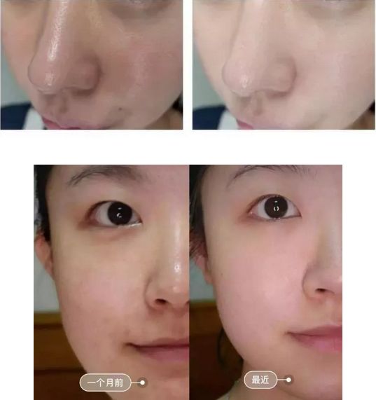 新西兰aeon绵羊油面霜,口碑最好的新西兰绵羊油面霜