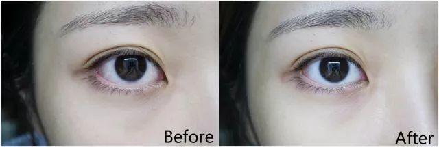 韩国眼膜紧致抗皱淡细纹爆款,好物去细纹眼膜排行榜10强