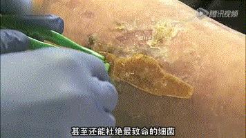 央视都推荐的新西兰国宝，1秒润喉，不咳嗽，口腔问题都好啦