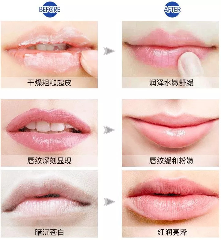 嘴唇干裂？世界最昂贵“液体钻石”，恢复水润，告别唇部细纹！