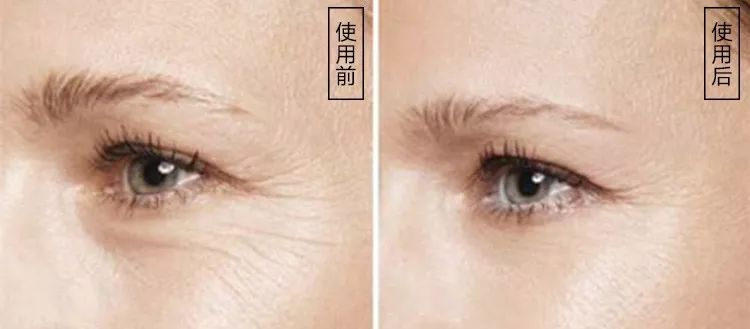 45岁没皱纹看起来像25岁,是如何做到的?