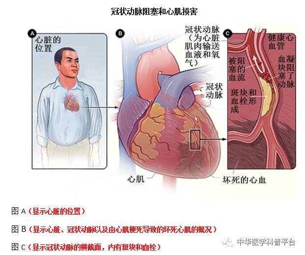 胸闷气短是怎么回事中医,胸闷气短是怎么回事跟生气有关吗