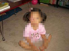 一粒小小的“针眼”,4岁女童差点丧命!就因为奶奶这个举动……