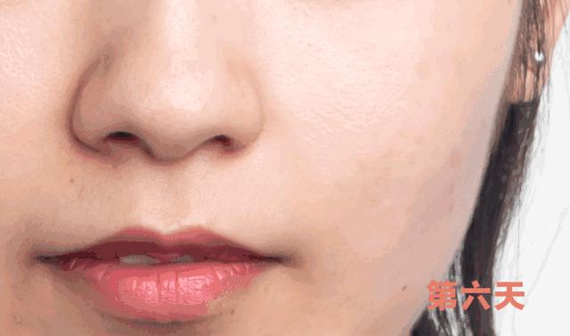 法令纹会让自己显老5到10岁,法令纹显老十岁教你解决