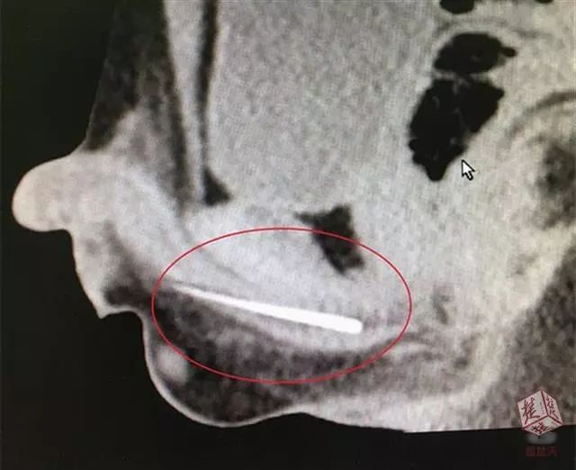 儿童玩刺激游戏,小孩居然玩这么刺激的游戏