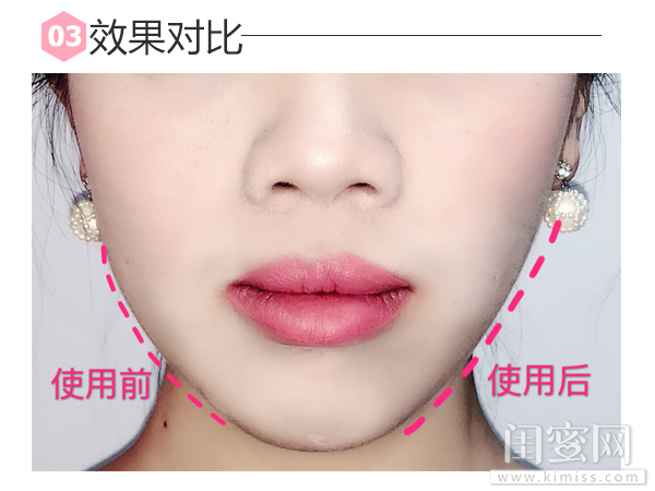 不开刀的“微整形”你值得拥有，ReFaCARATRAYFACE评测功课