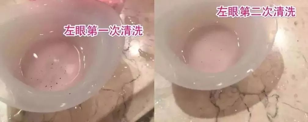 【海淘】用眼过度，酸胀疼痛+*血丝红**？5秒来一场冰泉SPA！爽爆了