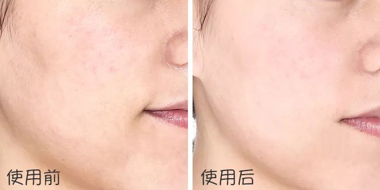 卖疯了!澳洲平价绵羊油,秋冬补水保湿首选,一罐用全身,英国女王都打call