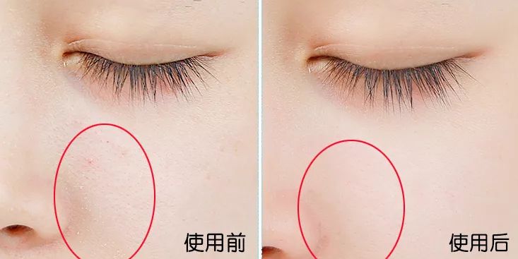 卖疯了!澳洲平价绵羊油,秋冬补水保湿首选,一罐用全身,英国女王都打call