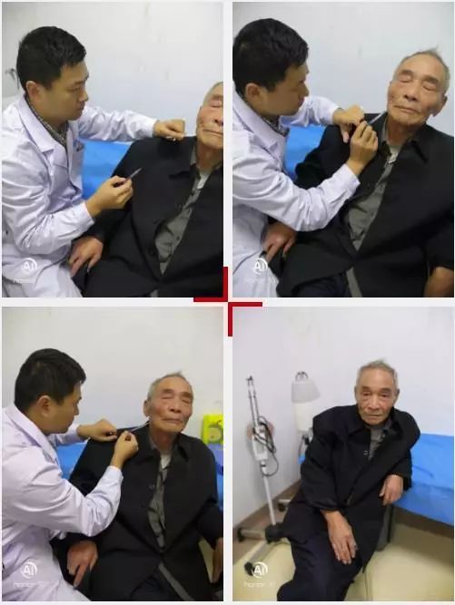 圣德医院神经内科开展信阳首例肉毒毒素治疗痉挛类疾病