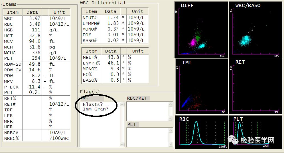 看懂血常规报告单只需明白这四项,宝宝做血常规要注意什么
