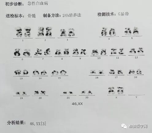 看懂血常规报告单只需明白这四项,宝宝做血常规要注意什么