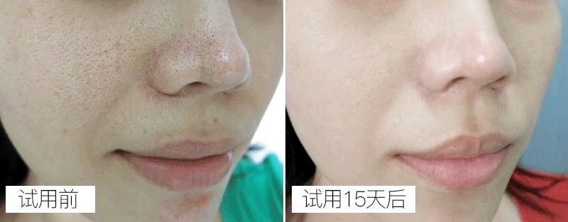 这样洗脸让你一步步毁容,这样洗脸让你皮肤越来越差