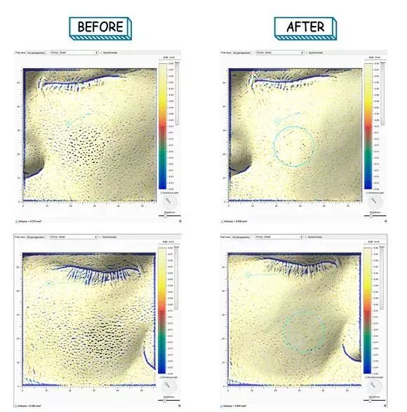 这样洗脸让你一步步毁容,这样洗脸让你皮肤越来越差