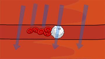 一张“示意图”告诉你，牙不好是怎样连累心血管的…