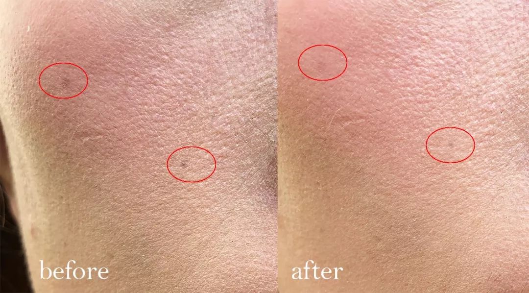 白得快又安全？YES！美白届的“新生”力量，这一小支做到了