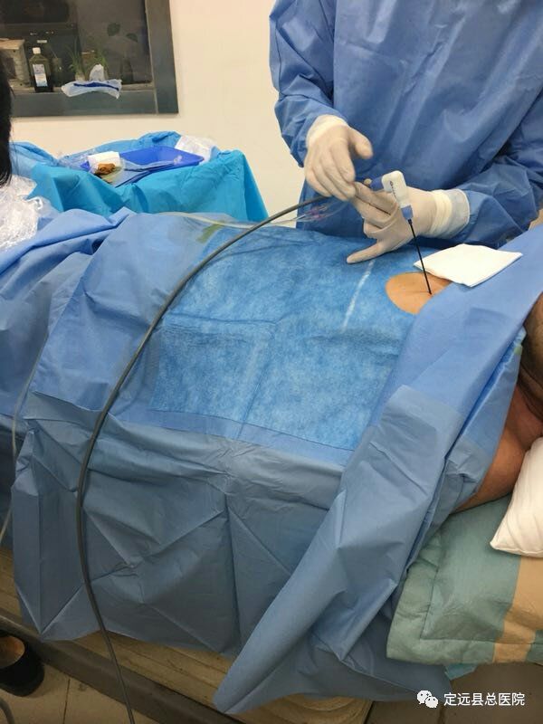 医院新闻我院成功开展微波消融术,定远总院能做介入手术吗