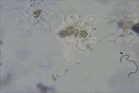 团购返场｜皮衣发霉、真丝变黄，除湿器帮你救活几万块的衣裳