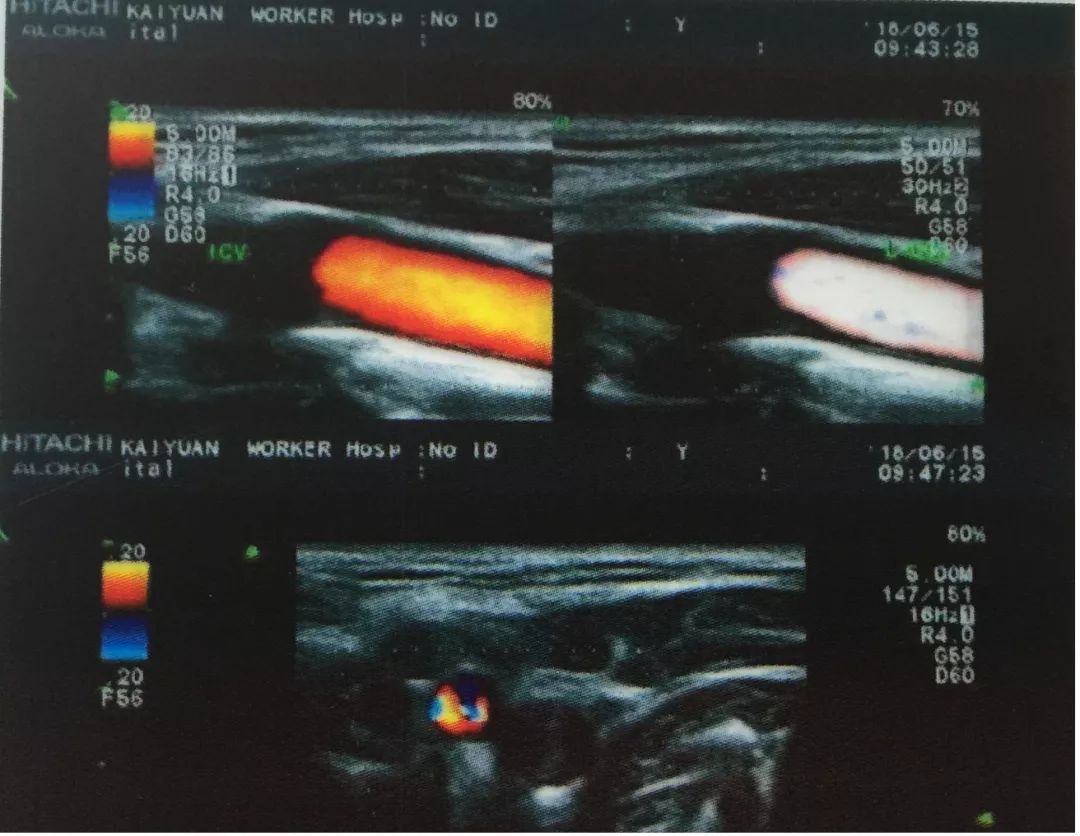 我州这类病患快看!开远这个医院有超赞的“医疗设备+专家诊断”,治疗更专业