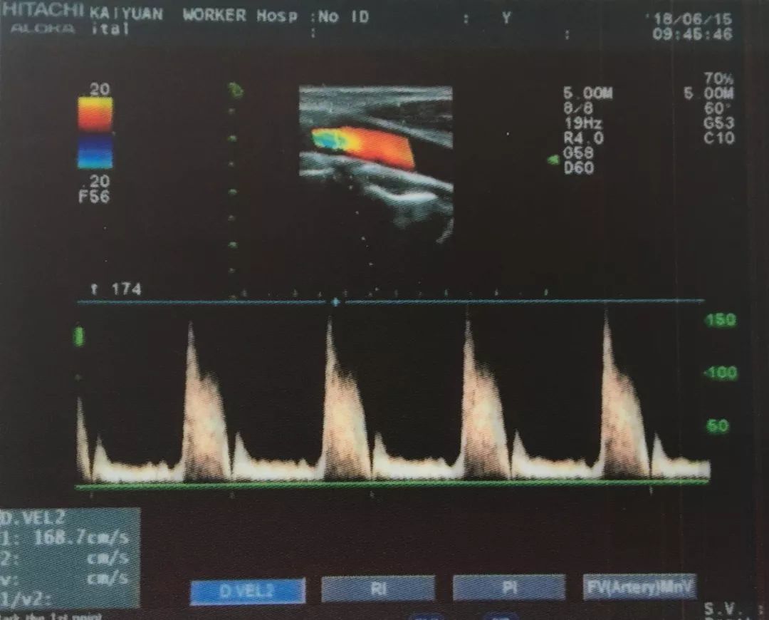 我州这类病患快看!开远这个医院有超赞的“医疗设备+专家诊断”,治疗更专业