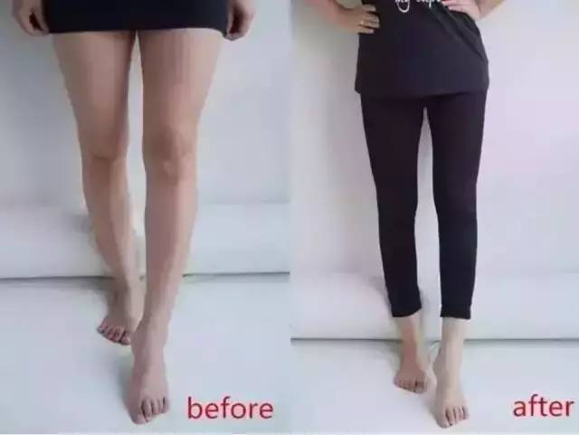 君君有货丨穿上它立刻显瘦10斤，秒变筷子腿，刘雯、唐嫣都爱它！