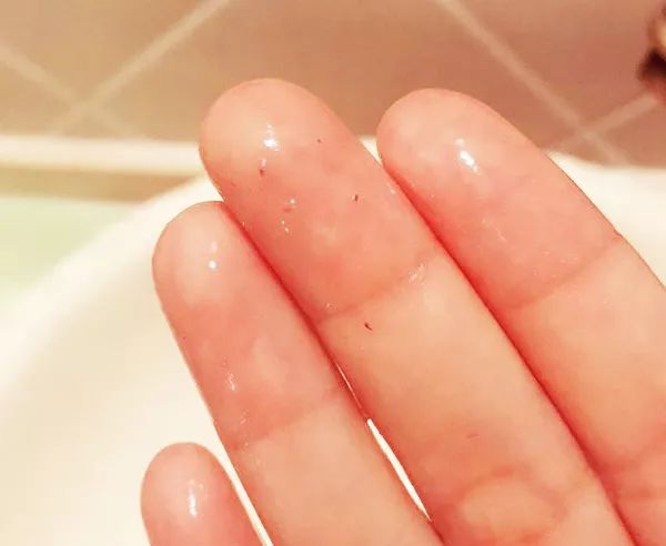 最有效去黑头和洁面的产品,你用过最好用的去黑头的产品