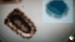 一星期不换衣服正常吗,一星期不换内裤的危害