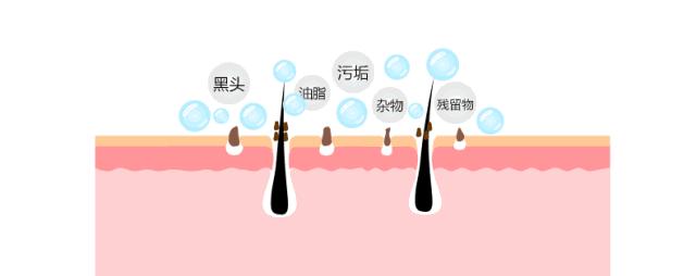 拨黑头工具草莓鼻,去黑头神器真的能吸出黑头