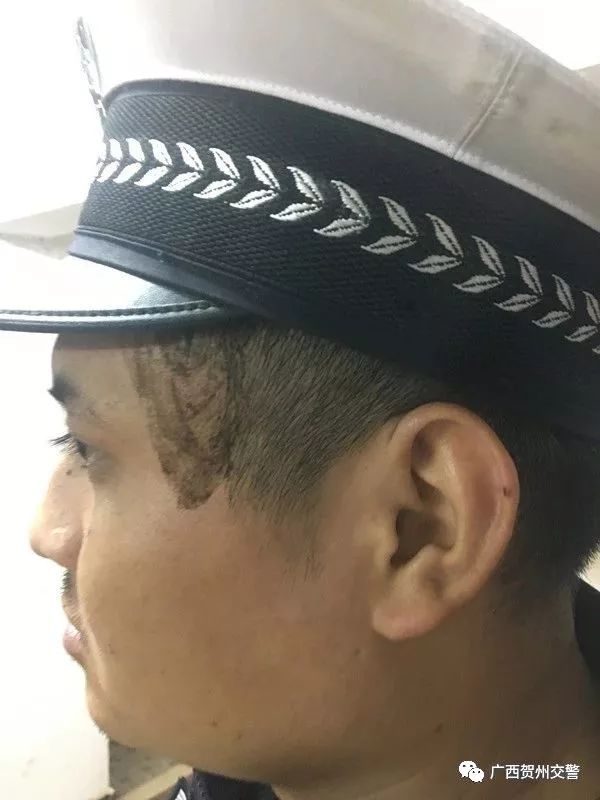 被蜂蛰交警,被蜂蛰求助交警