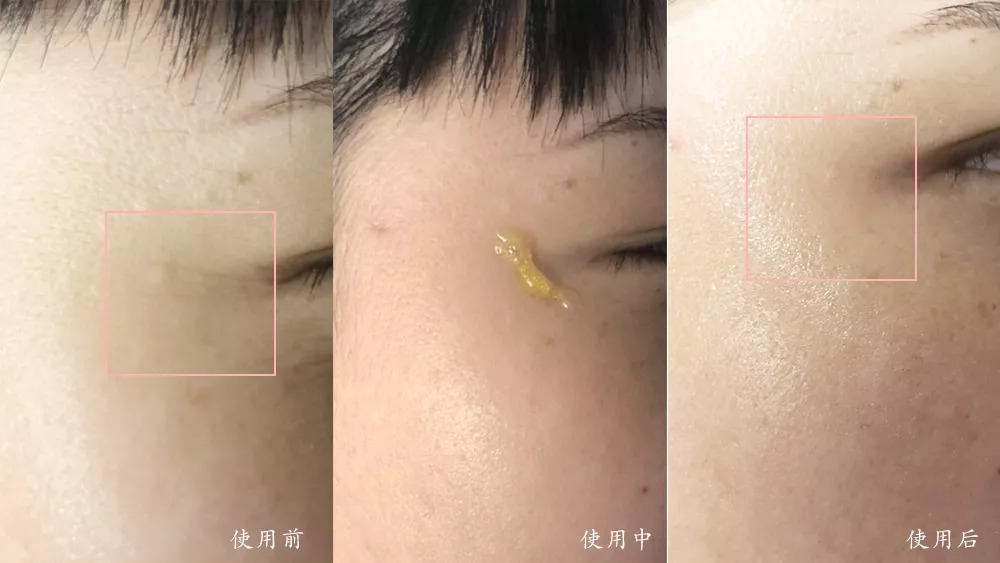 秋天养脾胃泡什么喝,入秋后煮它喝去湿毒