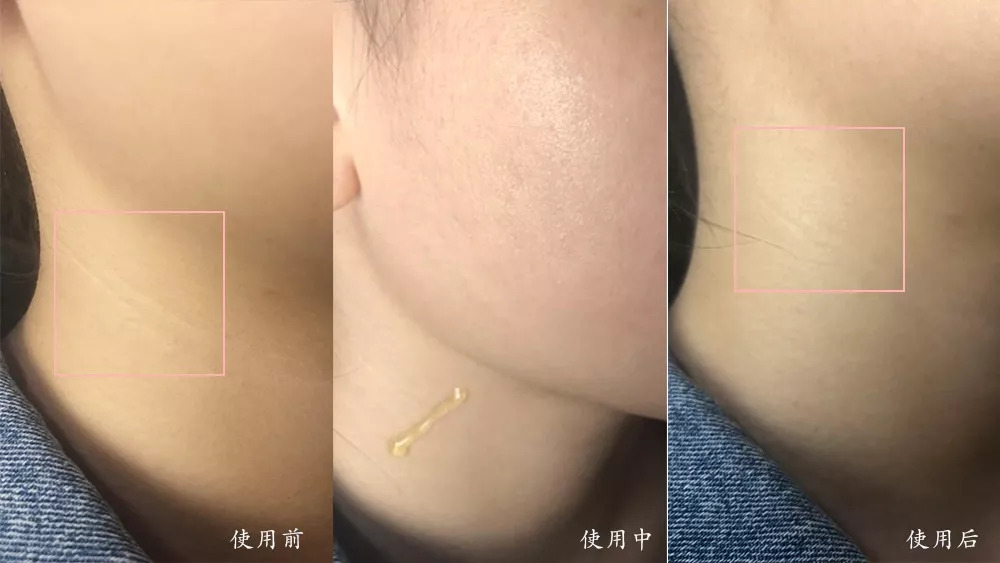 秋天养脾胃泡什么喝,入秋后煮它喝去湿毒