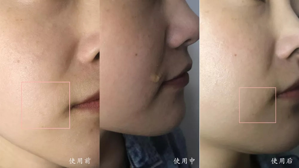 秋天养脾胃泡什么喝,入秋后煮它喝去湿毒