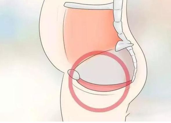 ella自曝产后尿失禁,ella产后尿失禁原因