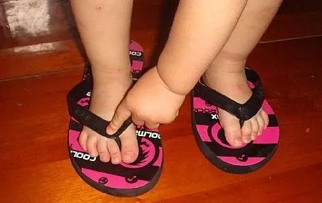 脚气脚臭难去除教你一招可以试试,脚臭脚气脚痒脱皮干裂一招根除