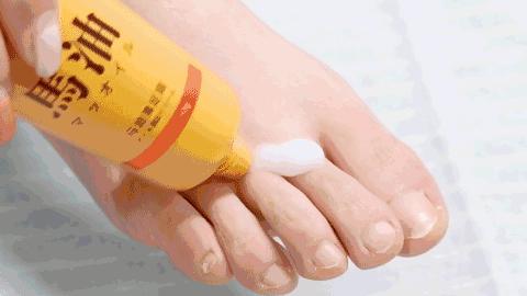 脚气脚臭难去除教你一招可以试试,脚臭脚气脚痒脱皮干裂一招根除