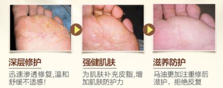 脚气脚臭难去除教你一招可以试试,脚臭脚气脚痒脱皮干裂一招根除