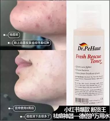 23岁后的女人用点好的!只需599元的SV冻龄水为何被誉为欧洲女性的驻颜神器?SV冻龄水胜于神仙水天然安全高效