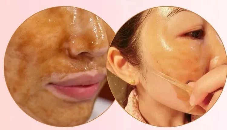 科普中药面膜,杏林微科普全集