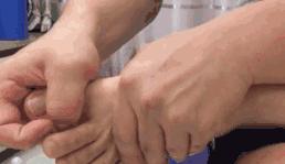 湿气不重但是很胖,泰国的祛湿足贴