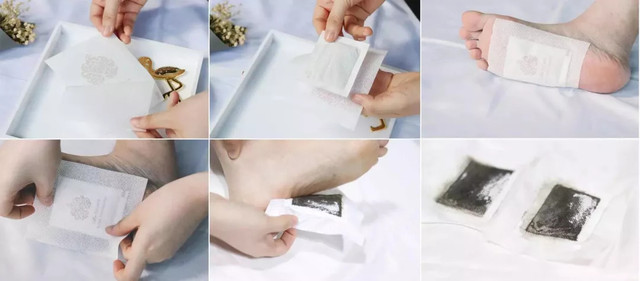 湿气不重但是很胖,泰国的祛湿足贴