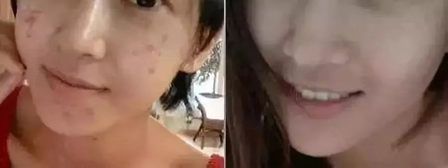 湿气不重但是很胖,泰国的祛湿足贴