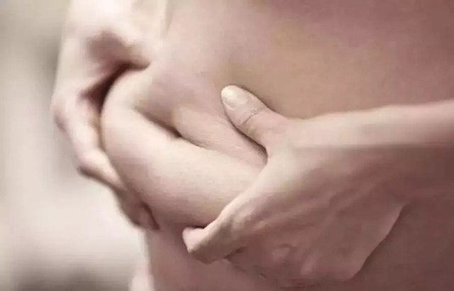 湿气不重但是很胖,泰国的祛湿足贴