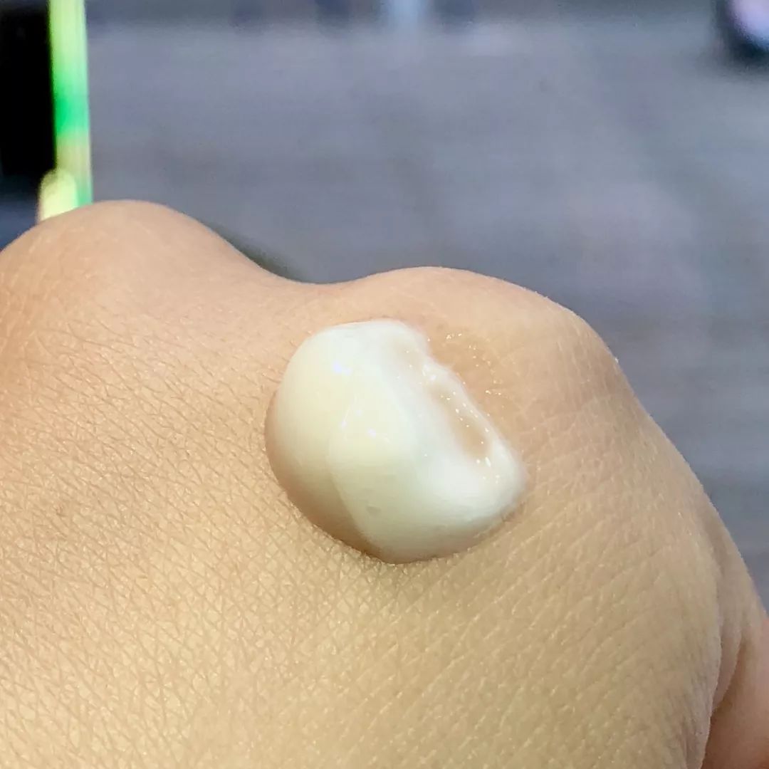 108块就能治好脸,感觉之前的钱都白花了