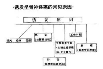 坐骨神经痛挂哪个科,坐骨神经痛的位置图