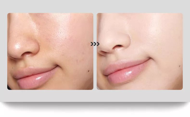 超级温和的修复面膜,非常安全的补水修复面膜