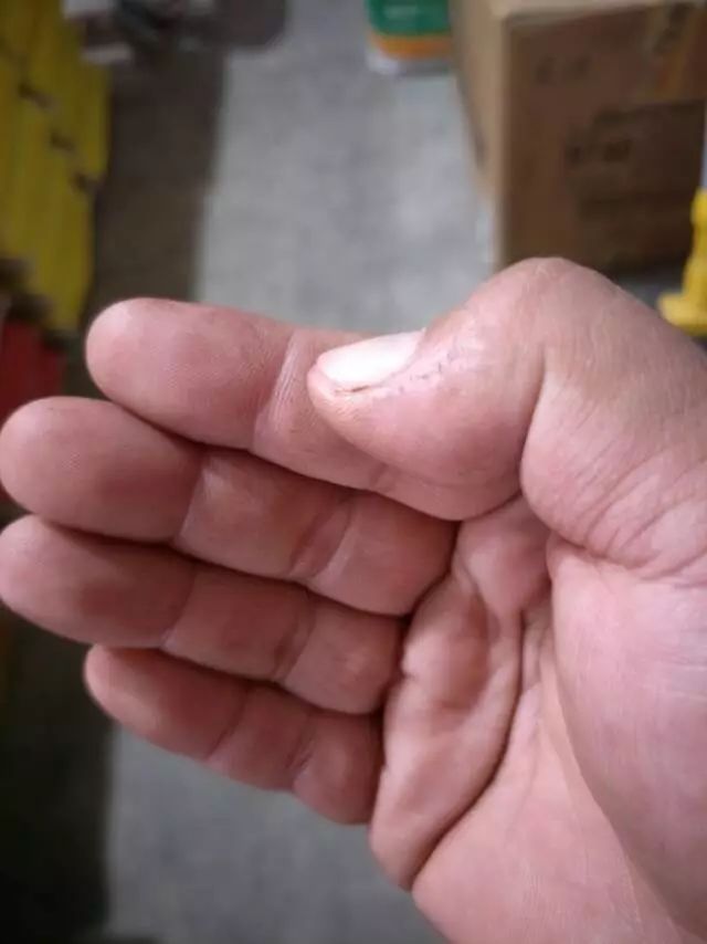 小麦刚出穗子倒了怎么办,小麦刚出苗叶发黄死棵咋回事